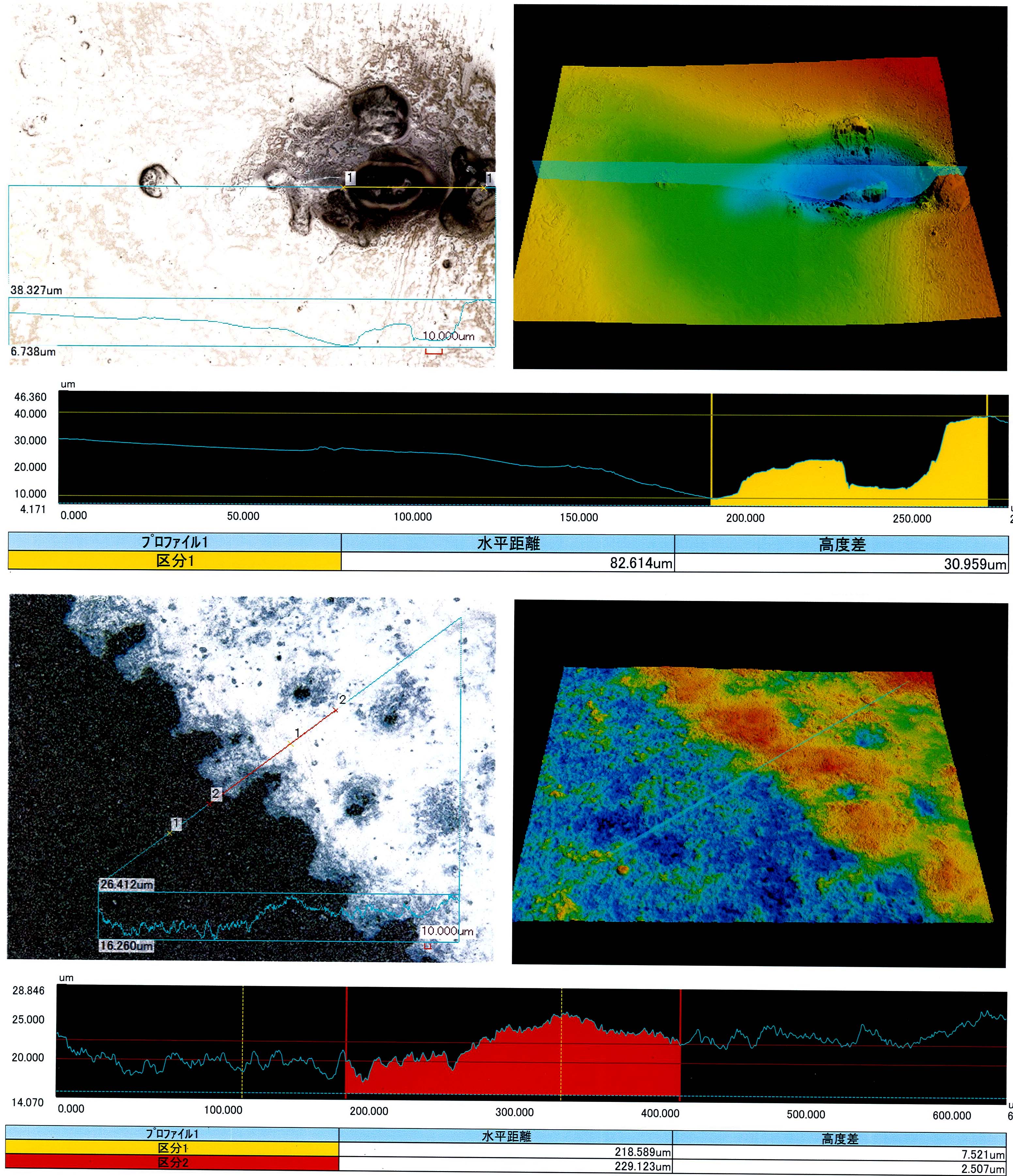 Shape analysis laser microscope inspection results